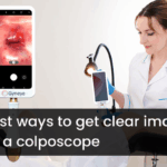5 Best ways to get good images with a colposcope